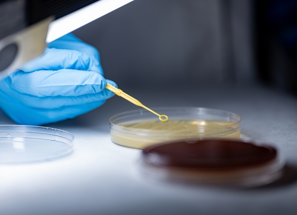 WhySavingBeesMeansSavingMicrobes_SpreadingPetriDishes_LaurelJarvis A biologist with a blue rubber glove on, spreads bacteria onto a Petri dish with a yellow plastic stick with a circle on the end. The petri dish is filled with yellow agar, and is next to another petri dish, darker brown in colour.